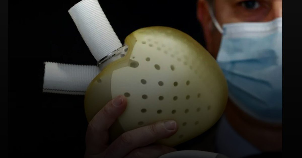 أطعمة تنظف شرايين القلب وتقي من السكتة الدماغية