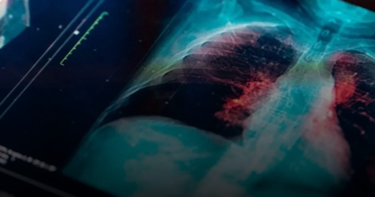 تلك أخطر 10 أنواع سرطان في العالم