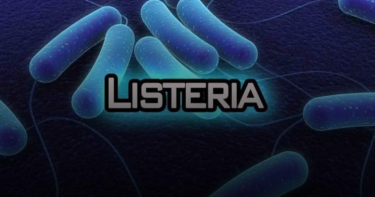 احذروا بكتيريا الأجبان .. منع استيراد 5 أنواع عالمية