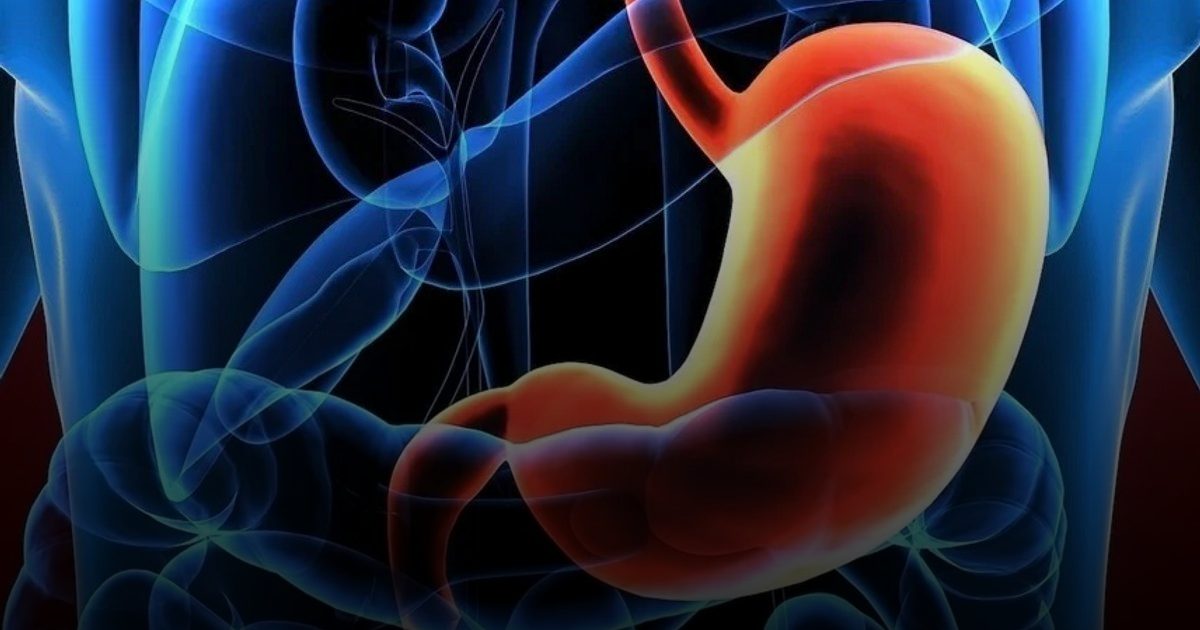 العلاج المناعي "دورفالوماب" يثبت فعاليته ضد سرطان المعدة