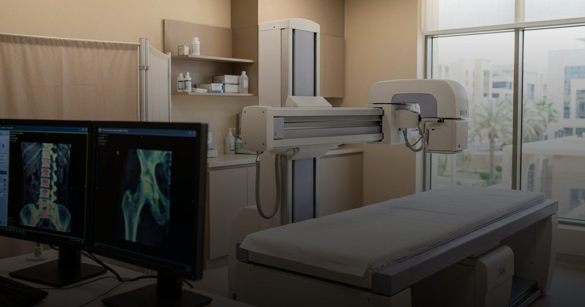 خبراء يحددون طريقة جديدة لحماية مفاصل النساء في سن اليأس