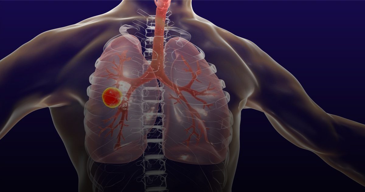 الصحة تحذر: تناول أدوية الدرن مع الطعام يهدد بظهور بكتيريا "فتاكة"