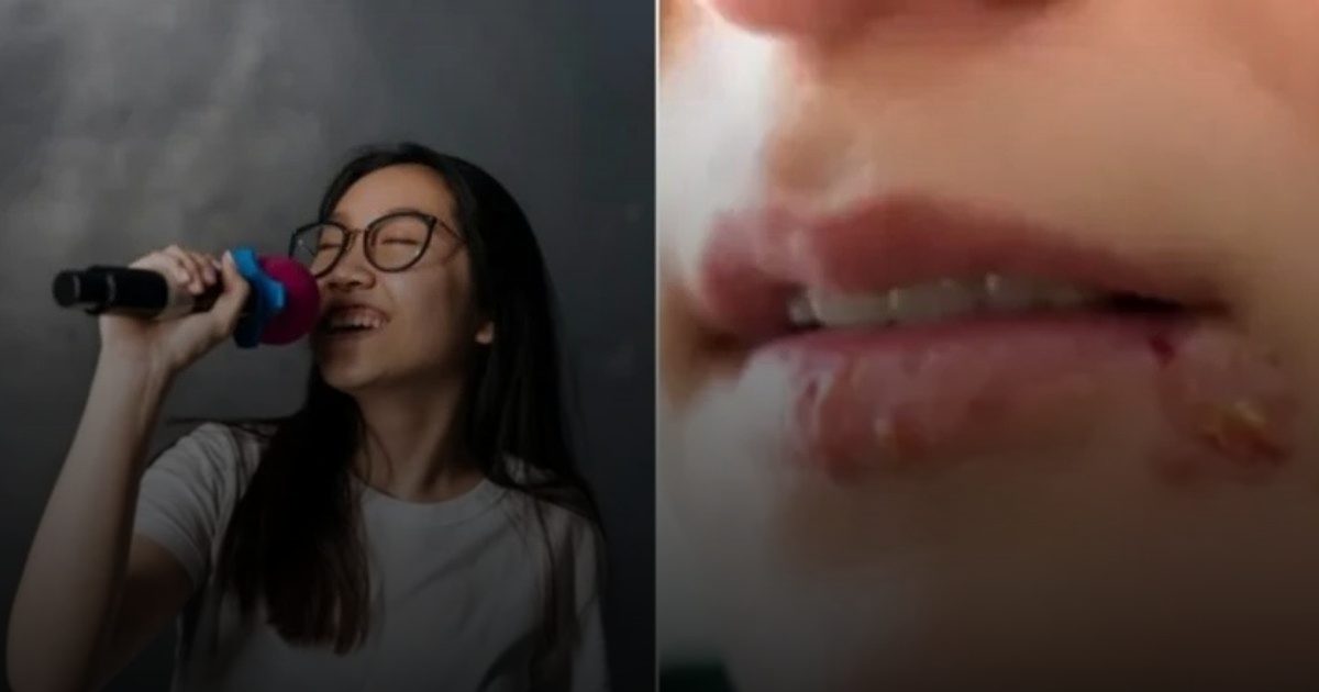 امرأة تصاب بفيروس الهربس منذ 8 سنوات..  والسبب ميكروفون