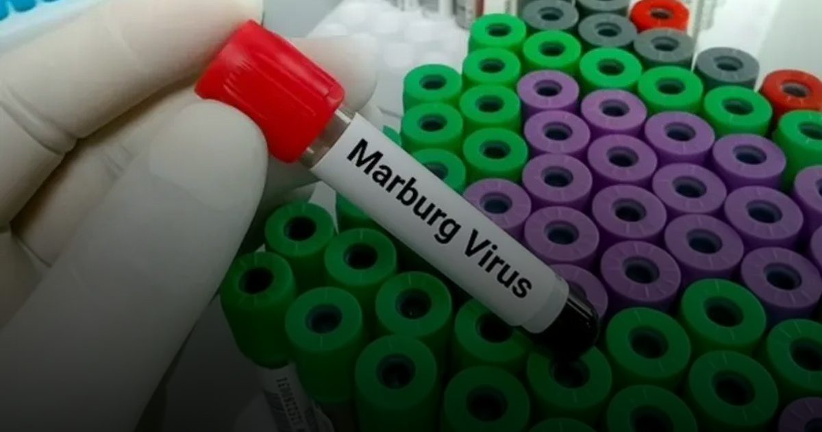 "وقاية" تُصنّف خطر "فيروس ماربورغ" بـ "منخفض" وتؤكد: احتمالية وفادته للمملكة ضئيلة