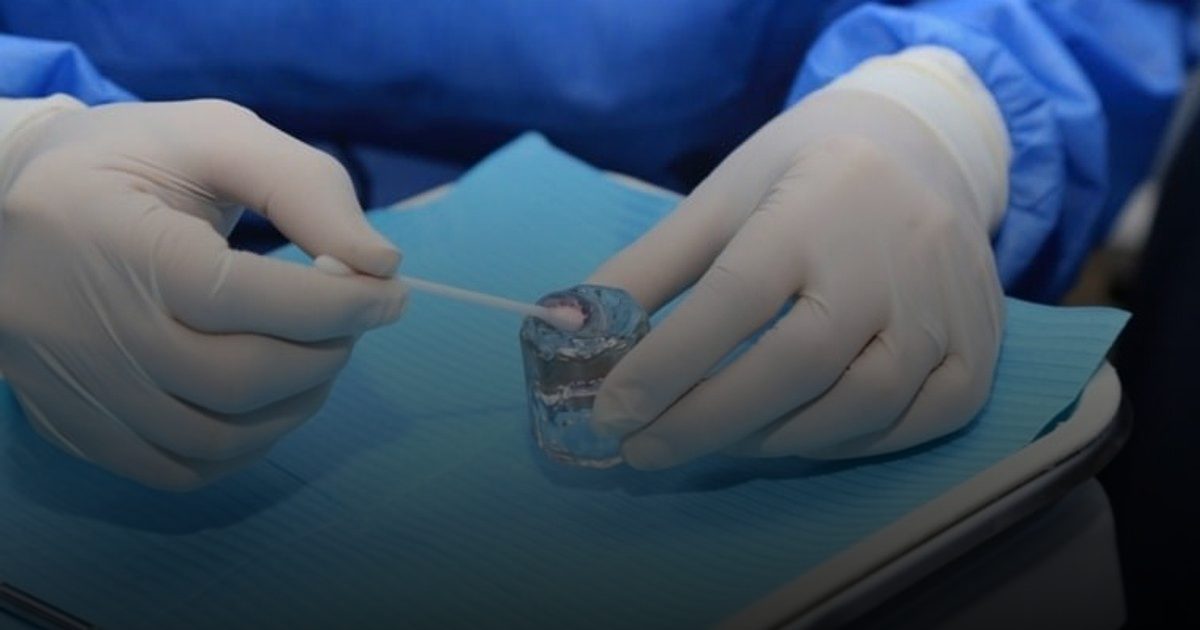 جل يقضي على التسوس ويعيد بناء مينا الأسنان في أسابيع