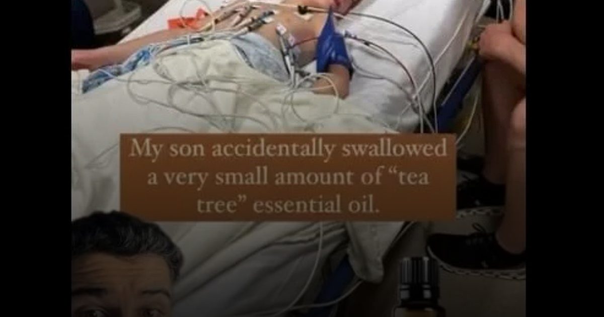 بعد دخول طفل في غيبوبة.. طبيب يحذر من "السم القاتل" في زيت شجرة الشاي
