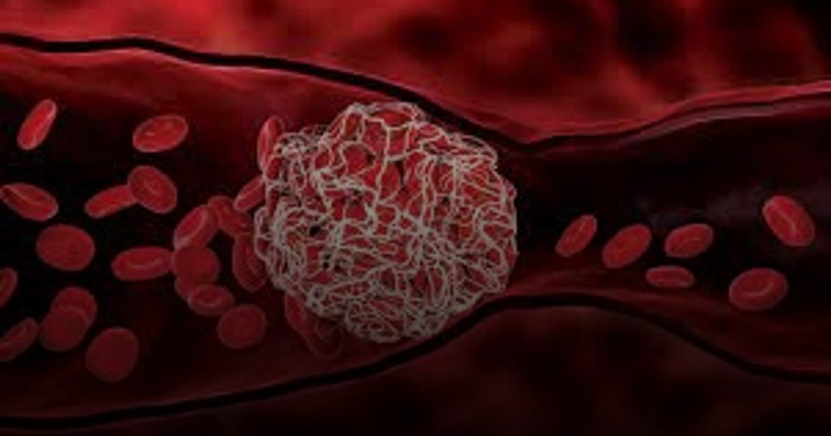 علماء صينيون يبتكرون "نانو-ميلانين" آمنة تمنع الجلطات الدموية دون مخاطر النزيف