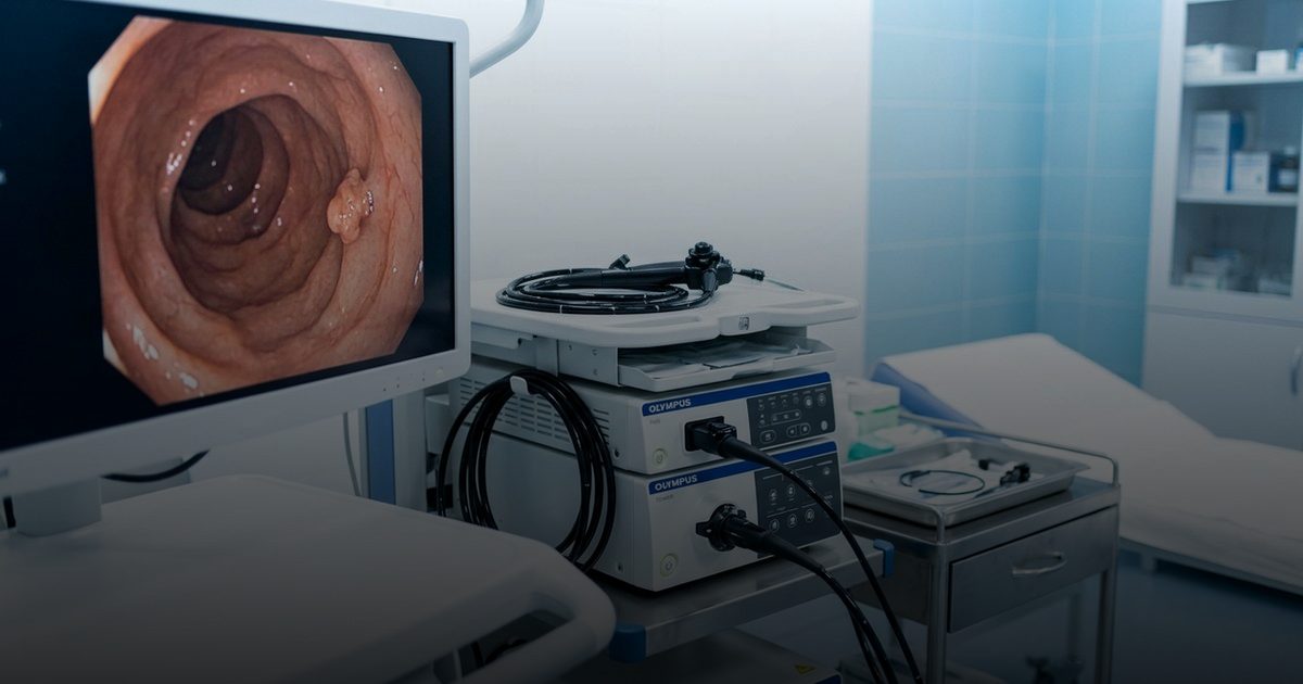 سرطانات الجهاز الهضمي: الأعراض وخطورة التشخيص الذاتي