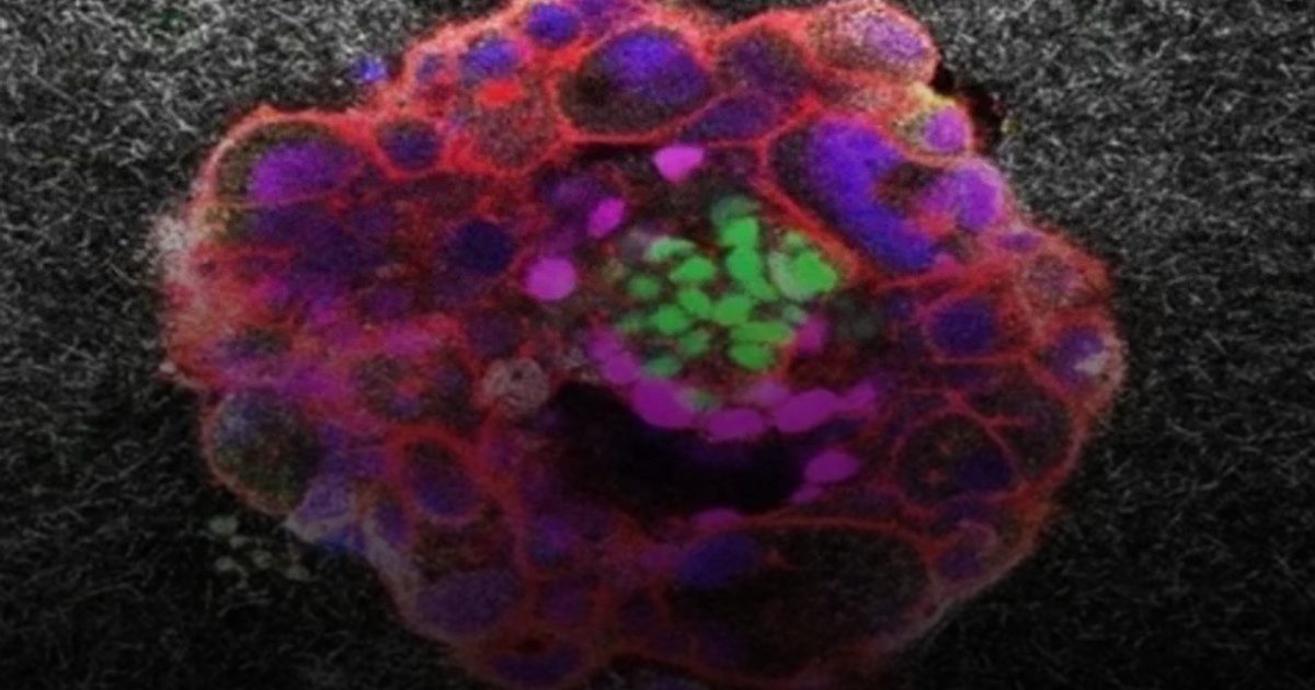 إنجاز طبي غير مسبوق: فيديو يكشف أسرار انغراس الجنين البشري