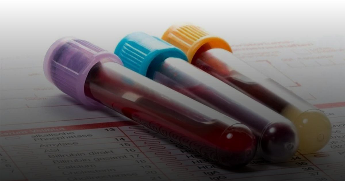 اختبار دم جديد يكشف سرطان المبيض في مراحله المبكرة