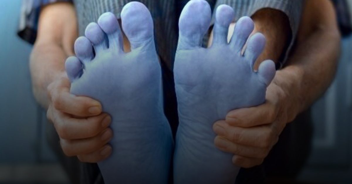 سر برودة الأطراف وعلاقتها بالأمراض المزمنة