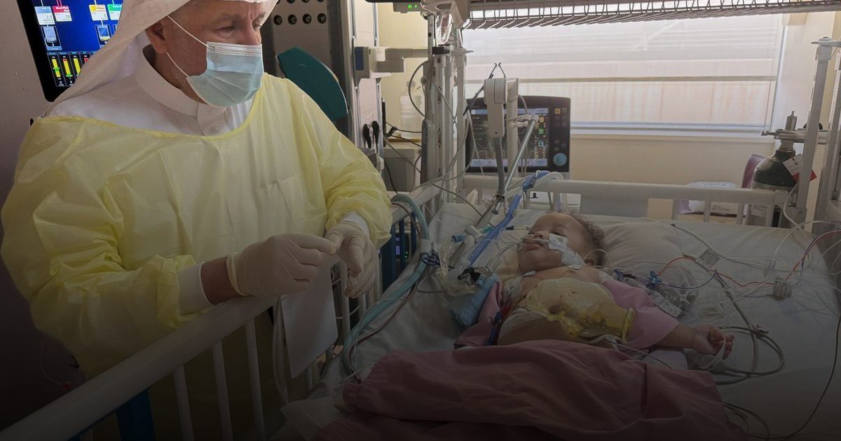 نجاح عملية فصل التوأم الصومالي بالرياض