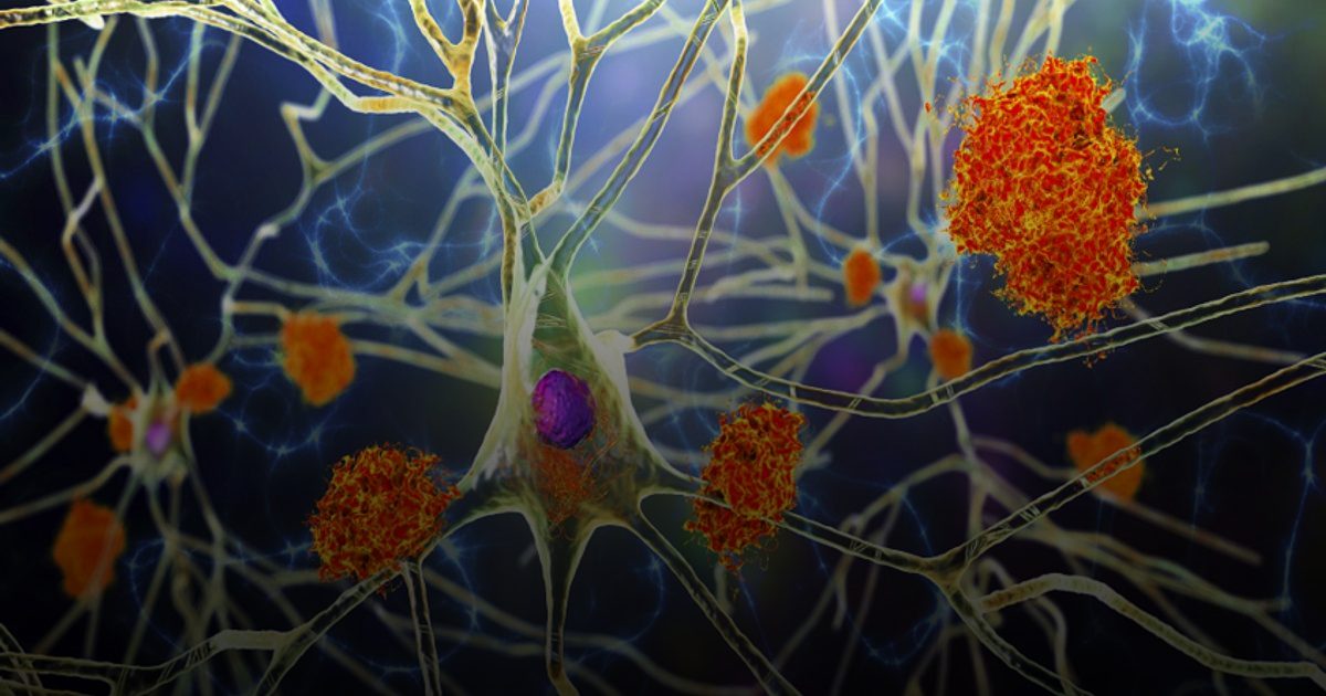 دراسة واعدة: الفياغرا ولقاح القوباء المنطقية قد يُحاربان مرض ألزهايمر