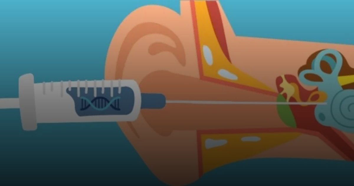 علاج جيني ينجح في استعادة السمع لدى مصابين بالصمم