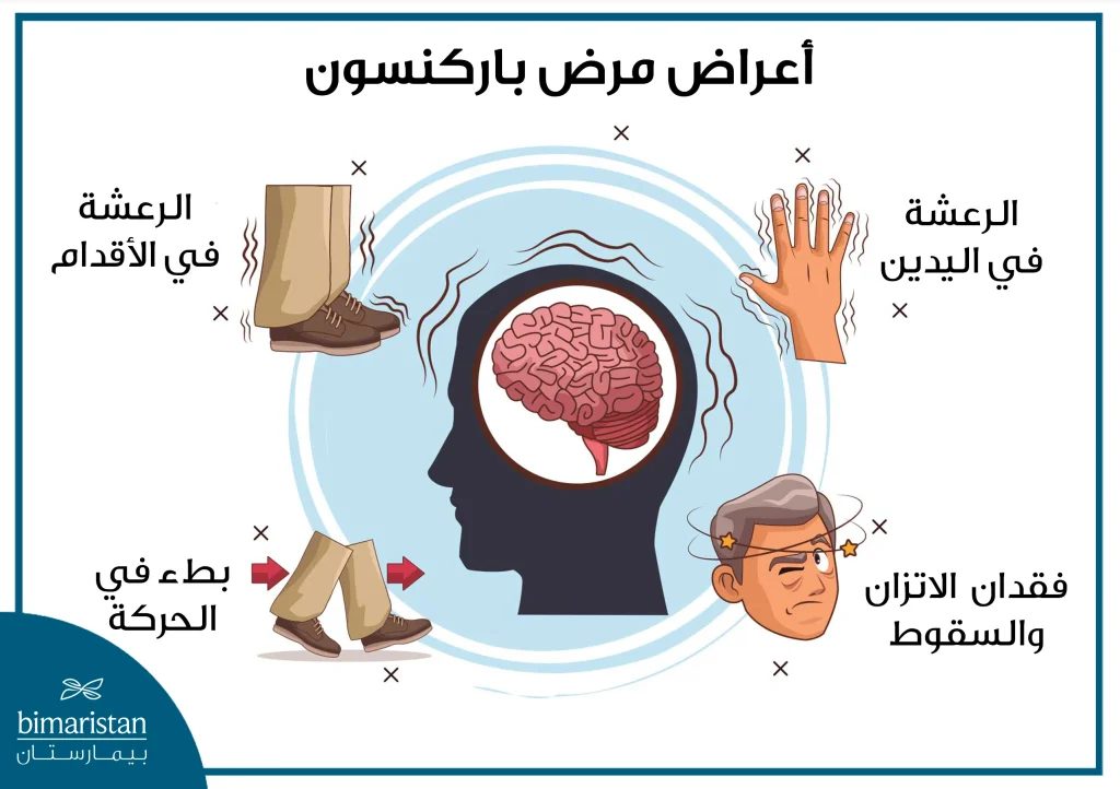 الذكاء الاصطناعي يكشف ارتباط الأحلام بمرض باركنسون