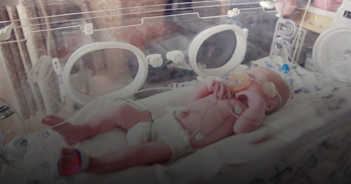 الولادة المبكرة. . رحلة صعبة وتحديات صحية ونفسية يواجهها الطفل