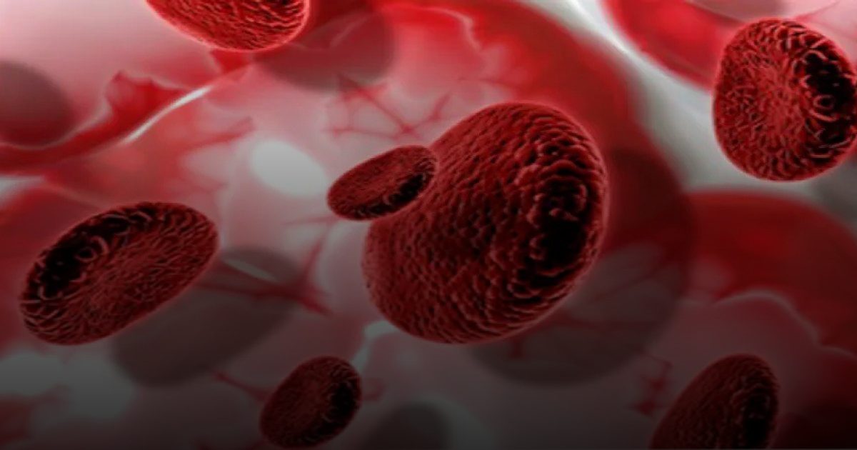 "اللوكيميا" مرض يمكن هزيمته ببارقة أمل في الخلايا الجذعية