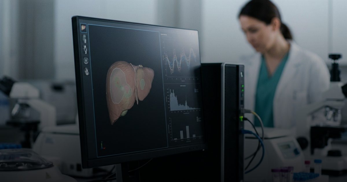 الذكاء الاصطناعي يُحدث ثورة في التنبؤ بسرطان الكبد