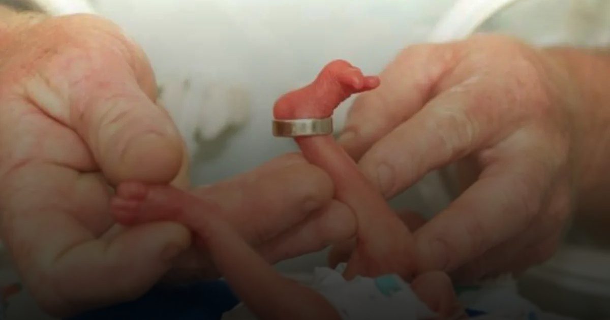 دراسة تكشف دور البلاستيك في ولادة مليوني طفل مبكرًا