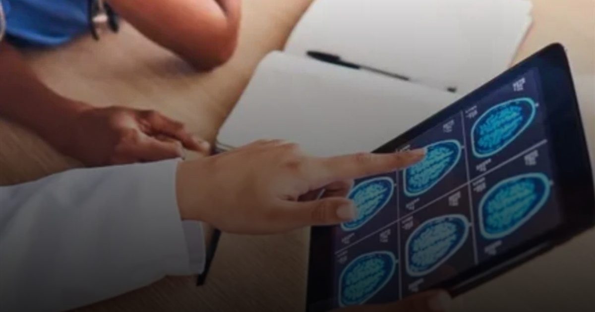 باحثون أستراليون يحققون تقدمًا في علاج أورام الدماغ منخفضة الدرجة