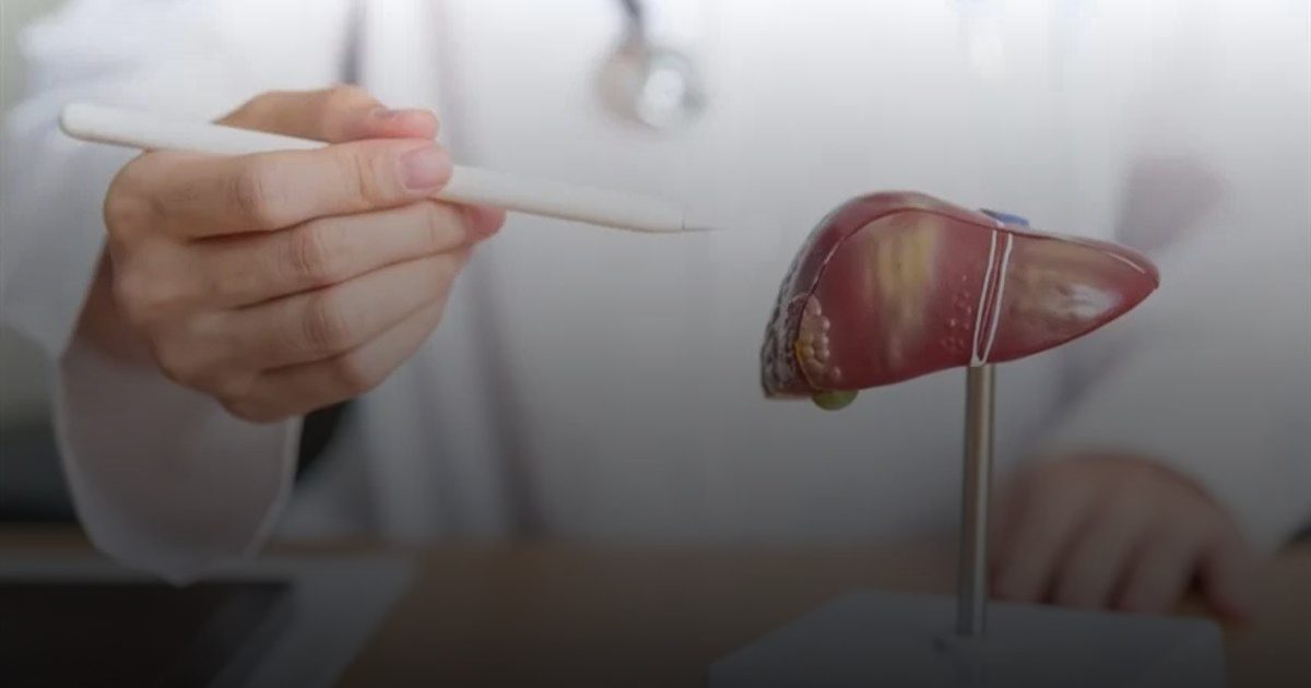 علماء يطوّرون علاجاً يُوقف تليف الكبد أو يعكس مساره