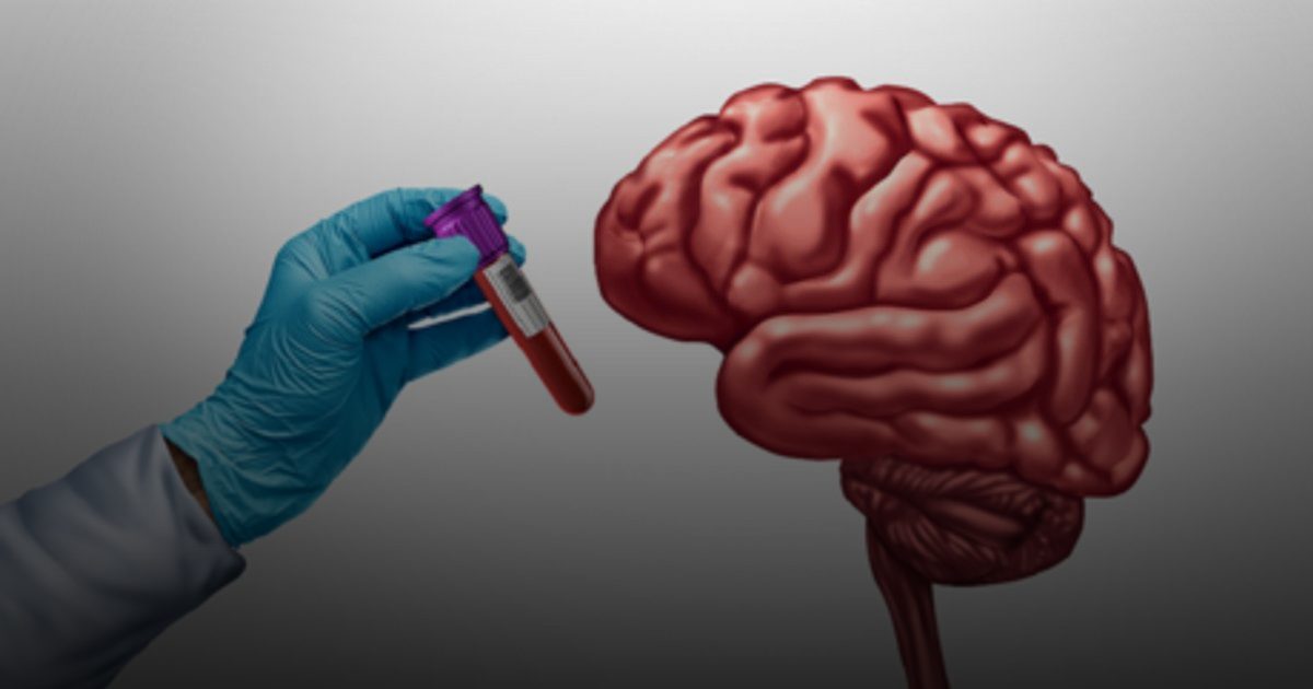 فحص دم للتنبؤ بالخرف قبل 25 عاماً
