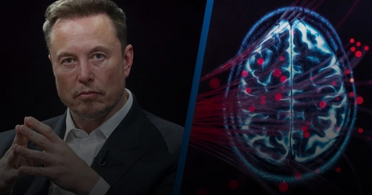 شريحة ماسك الدماغية تعيد الصوت لمريض ثالث