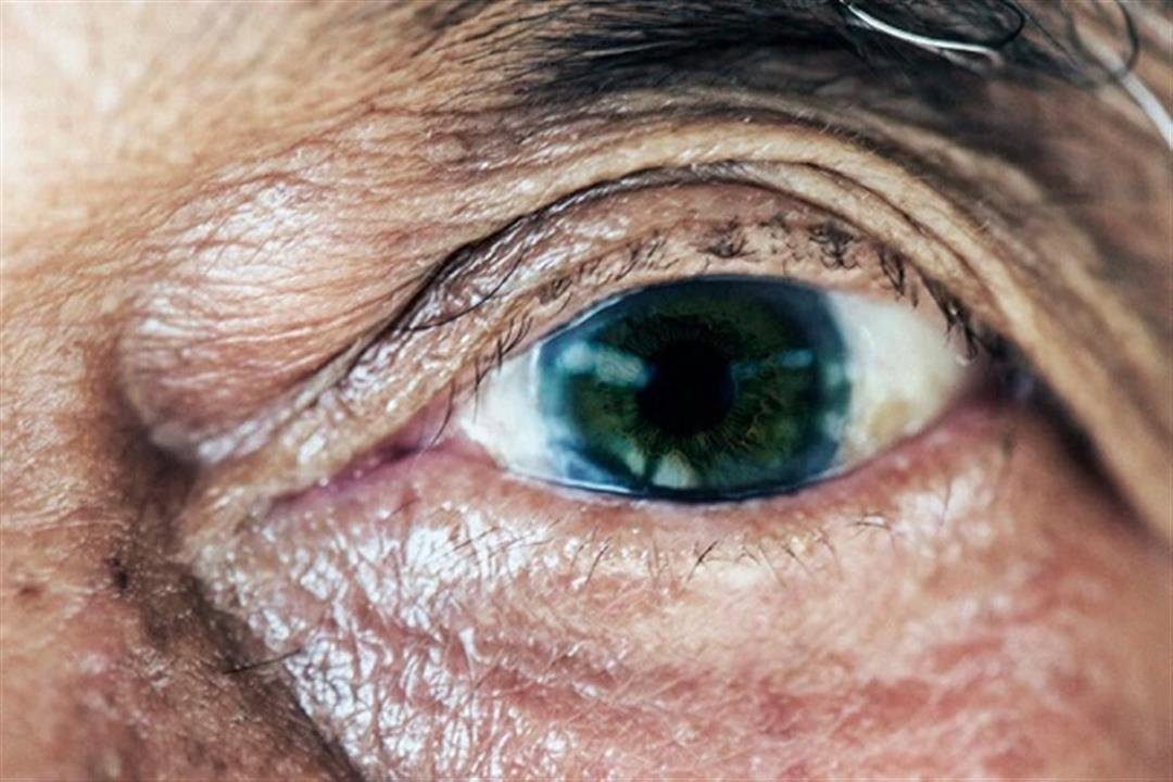 لكبار  السن.. كيف تحمى نفسك من الضمور البقعي فى العين؟