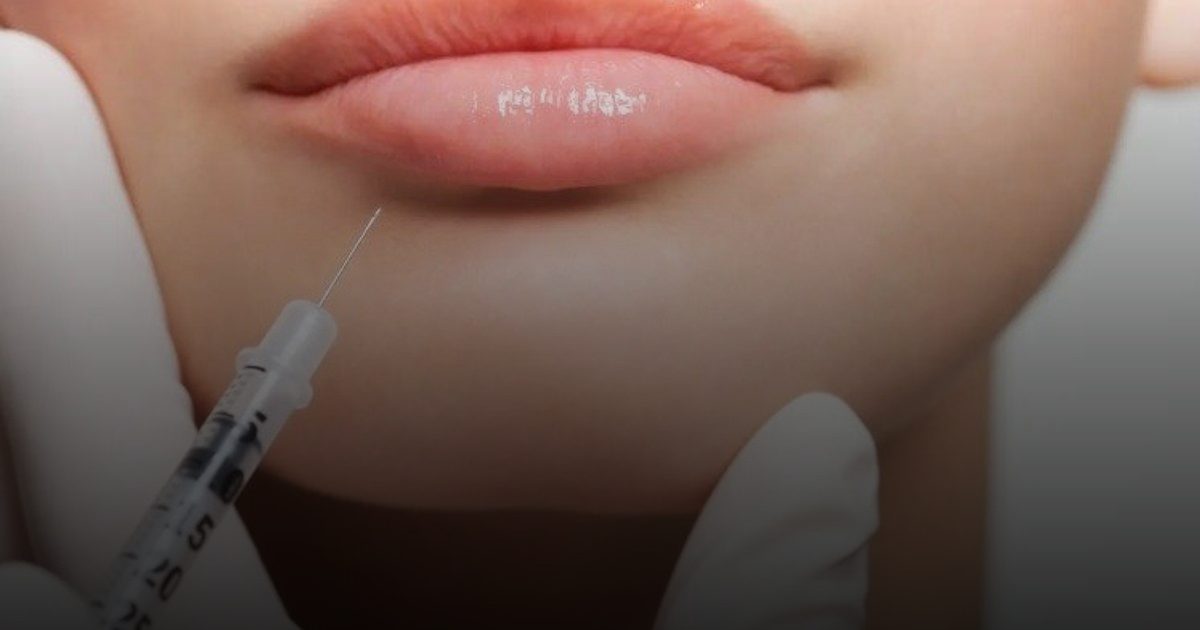 الرجال يفضلون الشفاه الطبيعية رغم هوس الفيلر