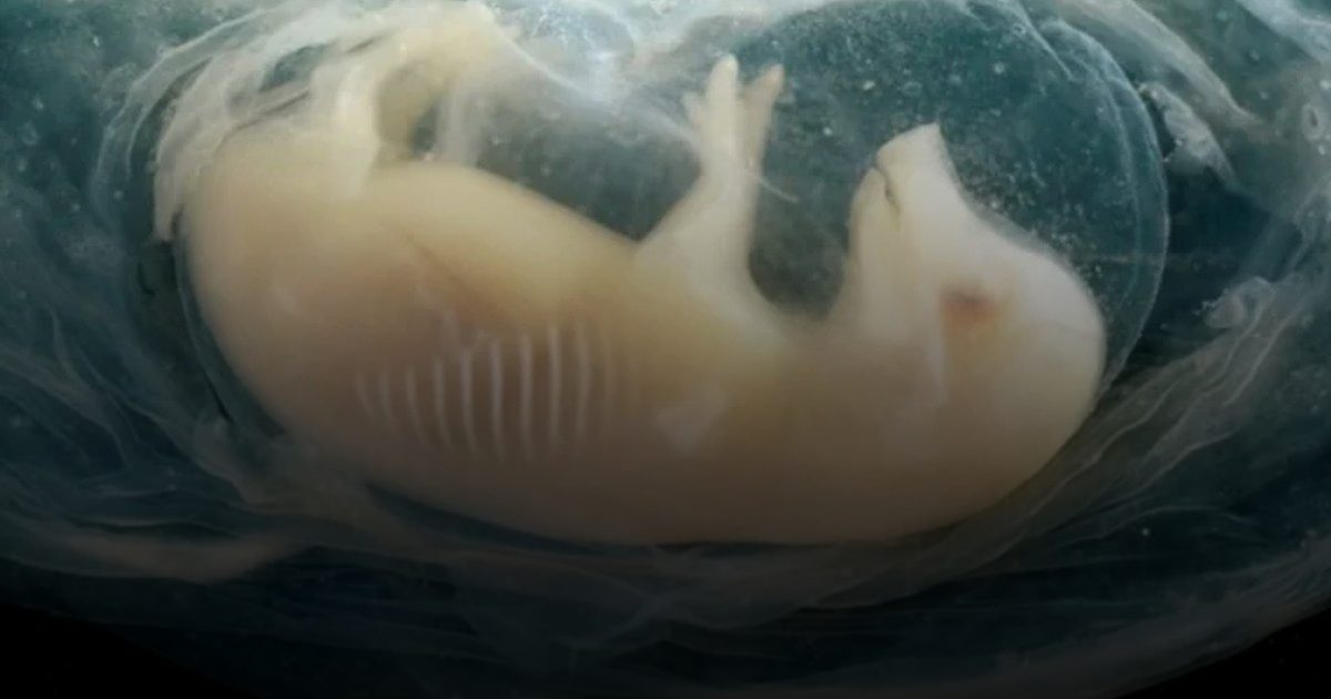 علماء يزرعون أنسجة قلب بشري في جنين خنزير