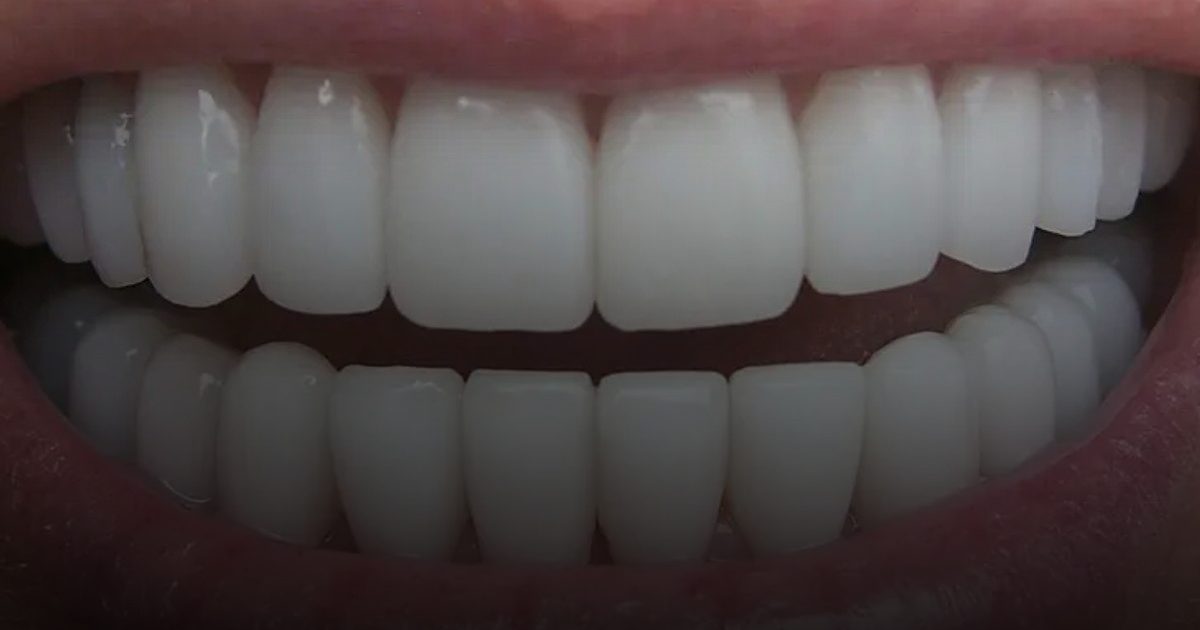 نظافة الأسنان تمنحك عقدًا إضافيًا من العمر وتحمي الدماغ من "الخرف"