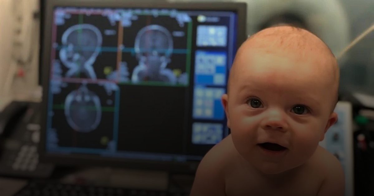 الذكاء الاصطناعي يقدّر عمر دماغ الرضيع بدقة متناهية