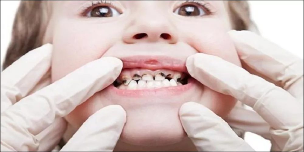 إهمال صحة الفم: بوابة لأمراض القلب والجهاز الهضمي
