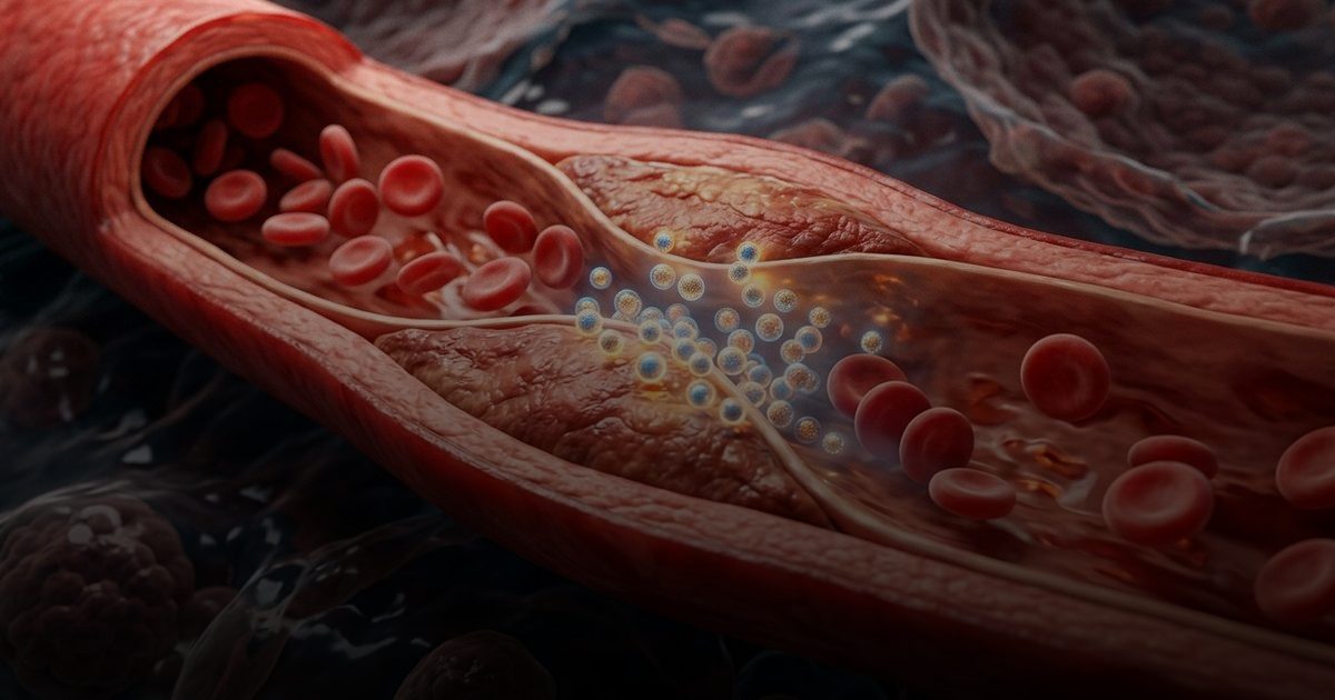 تقنيات النانو تُحدث ثورة في علاج انسداد الشرايين