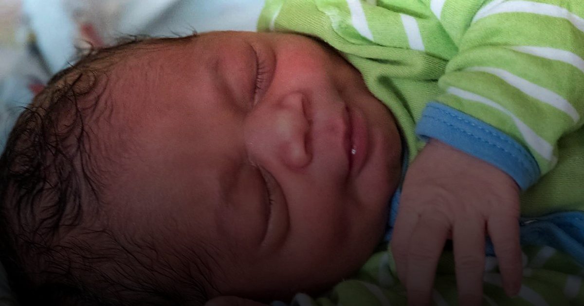 فريق طبي بصبيا يزيل التصاقًا باللسان لمولودة