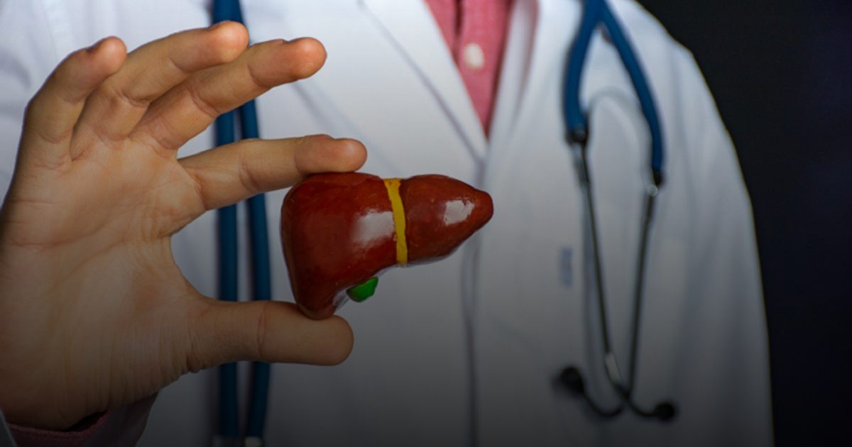 دراسة تحذر: الكبد الدهني غير الكحولي يزيد خطر الوفاة بالسرطان 35 مرة