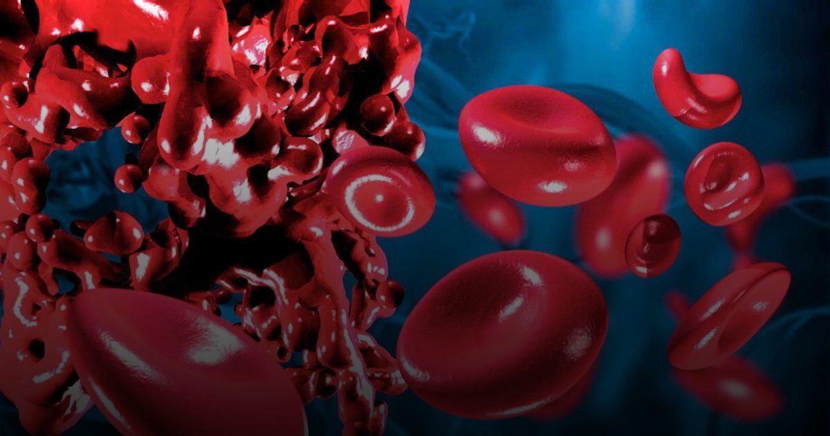 نقلة نوعية .. التنبؤ بالجلطات الدموية والعزل بمخلفات النخيل إنجازان جديدان لجامعة إماراتية