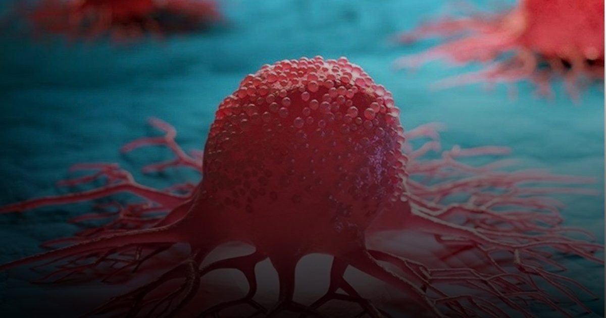 تحليل عالمي: 38% من حالات السرطان ليست "قدراً حتماً" ويمكن منعها بسلوكيات بسيطة