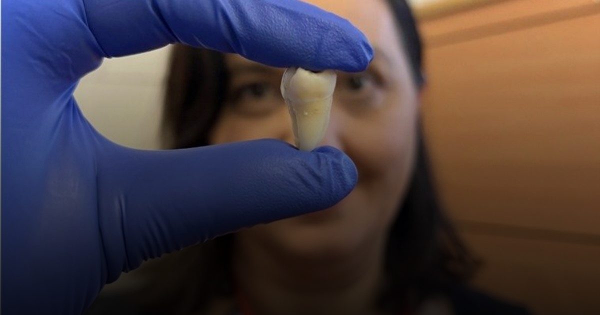 إنجاز علمي.. باحثون يزرعون أسناناً بشرية في المختبر لأول مرة