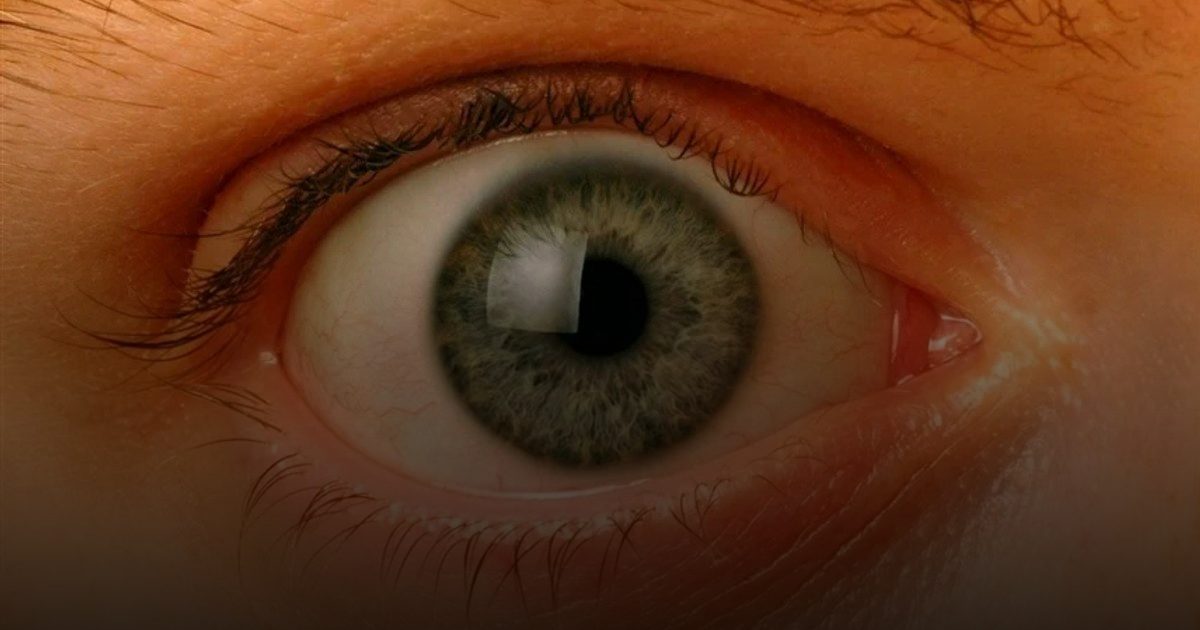 سبعينية تستعيد بصرها عبر سنّها بفضل جراحة نادرة