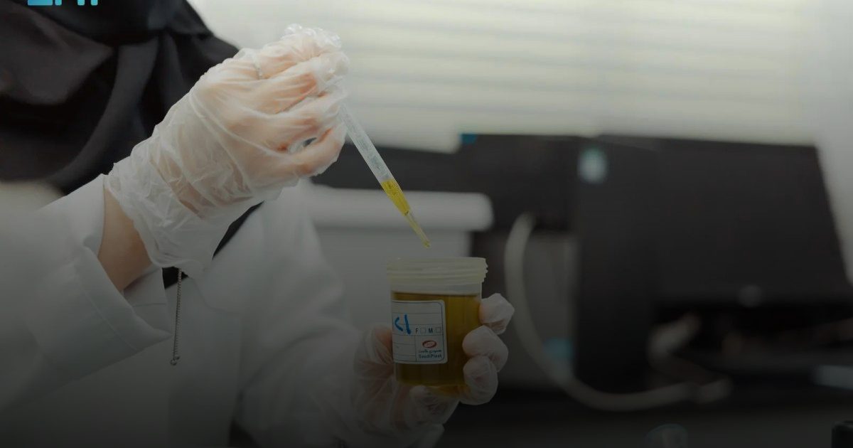 مختبر سلامة الأغذية بأمانة الجوف يُجري 4500 اختبار لمنتجات مهرجان الزيتون