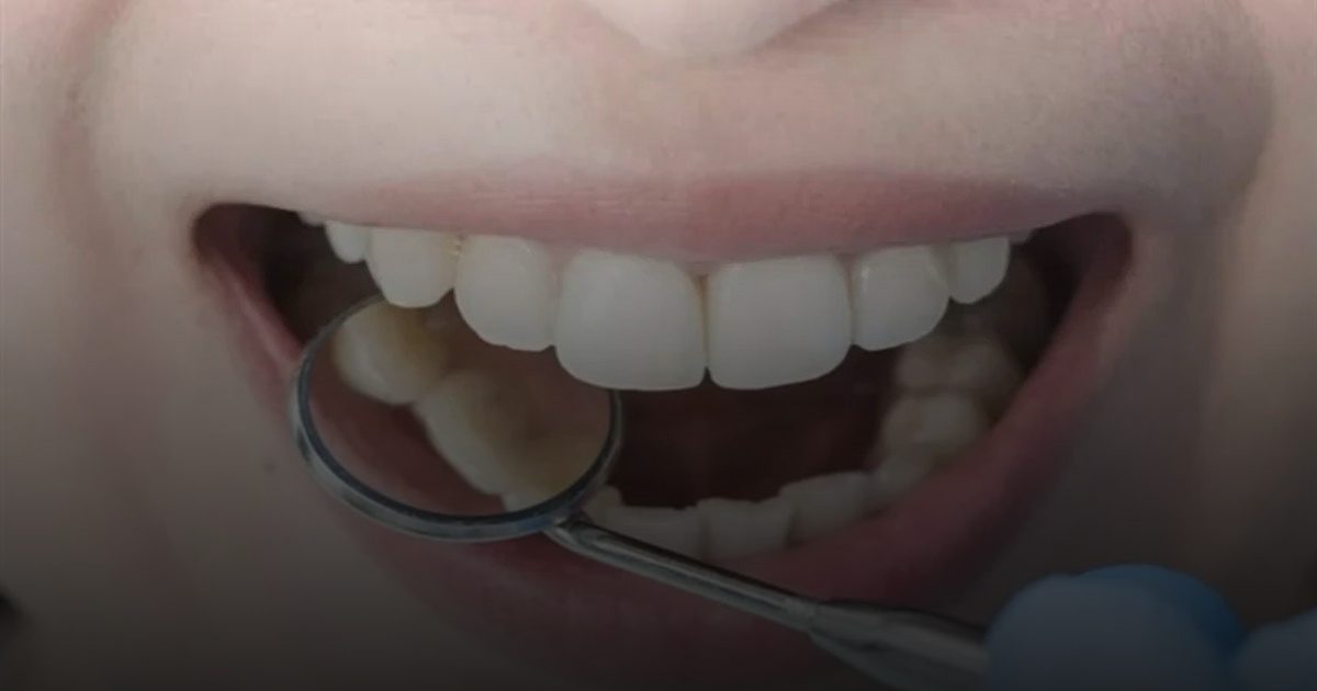 صمام أمان حيوي: عدد أسنانك السليمة "المؤشر الذهبي" للتنبؤ بطول العمر