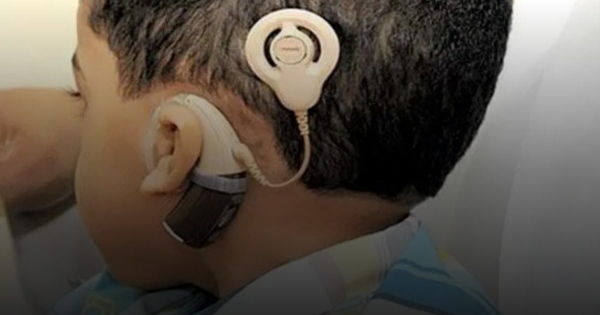 126 عملية زراعة سمعية باستخدام أحدث التقنيات العالمية بالأحساء