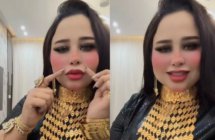 ضبط منتحلة صفة طبيبة تجميل تدير منشأة غير مرخصة