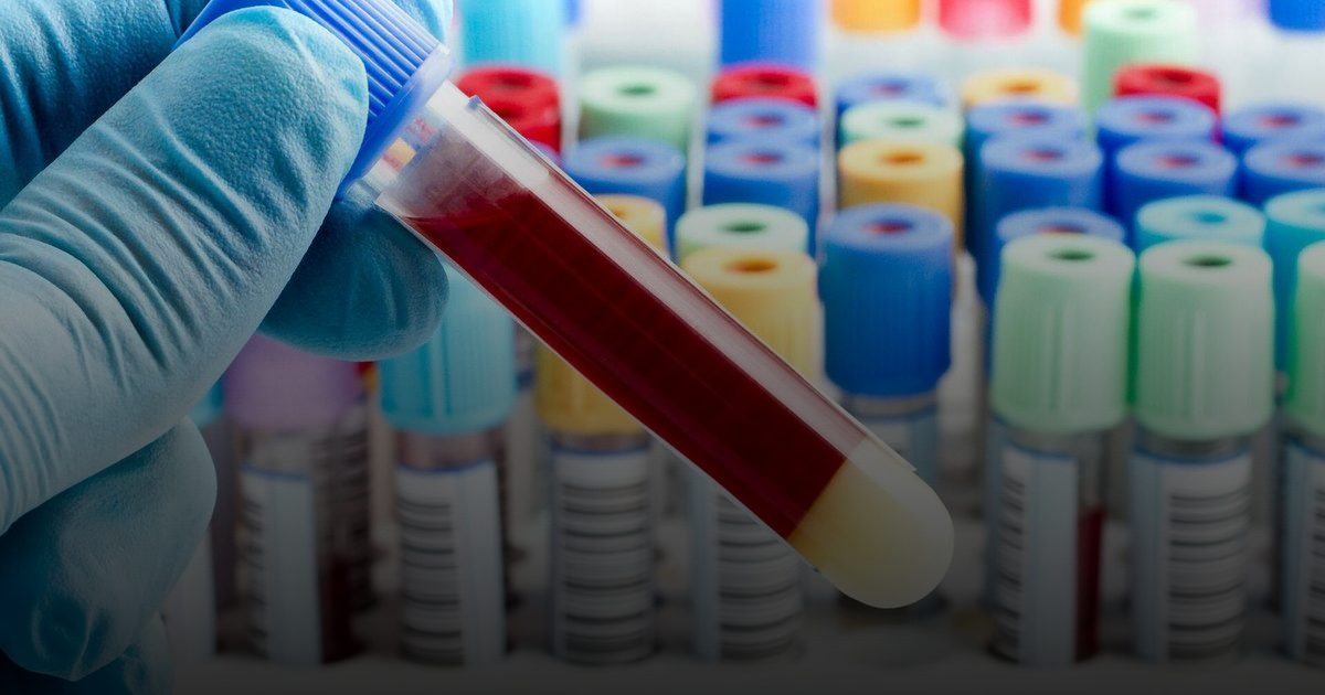 اليابان تنتج دماً صناعياً لعلاج الحالات الحرجة