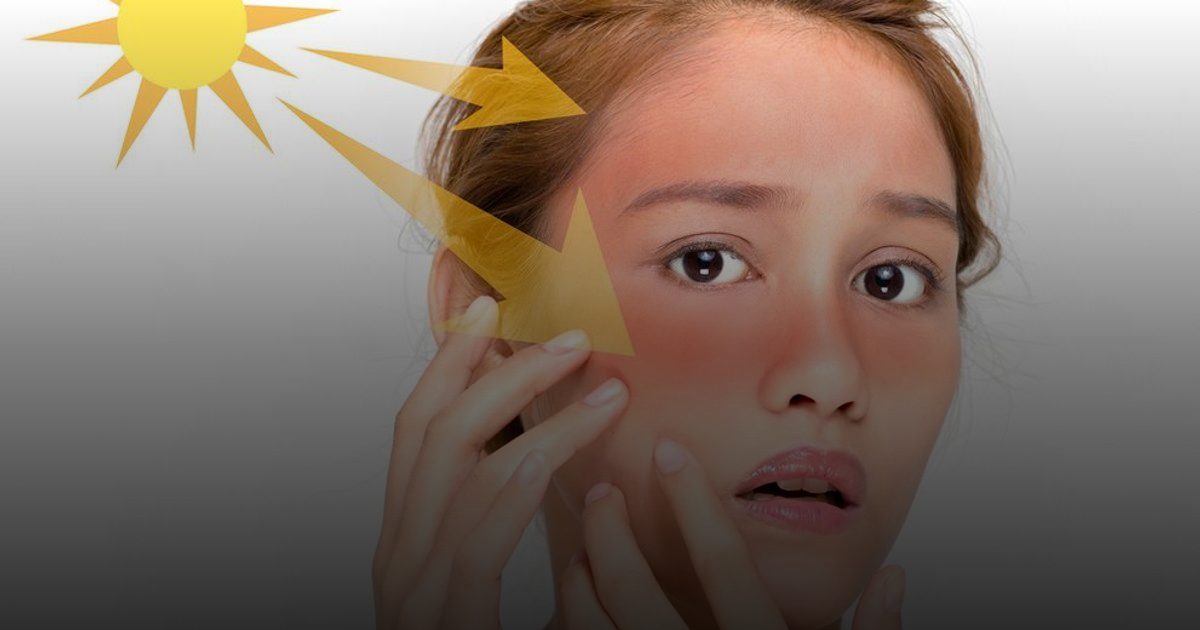 نصيحة طبية: احم بشرتك من أشعة الشمس