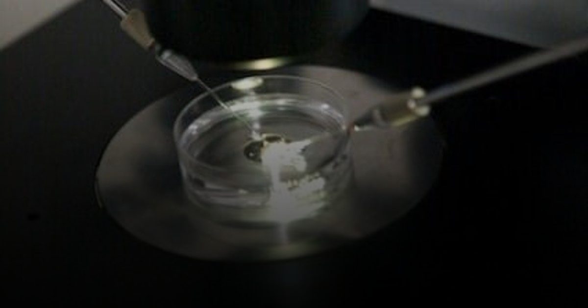 علماء: خلايا الجلد تنتج بويضات لعلاج العقم