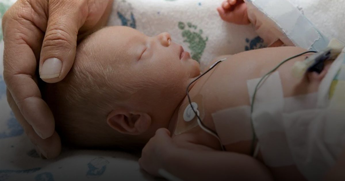 الولادة المبكرة قد تعطّل عمليات نمو الدماغ