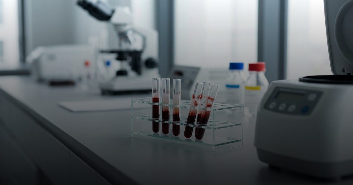 فصيلة الدم مؤشر جديد لمخاطر السكري والتدخل الوقائي