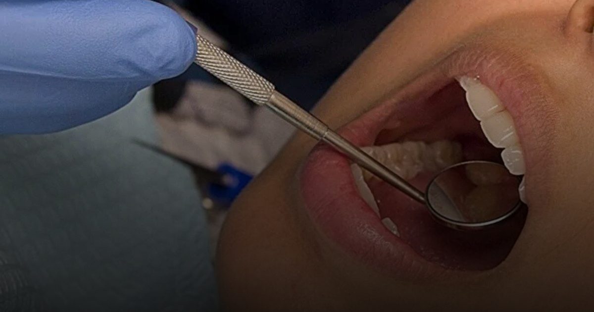 دراسة حديثة: صحة الفم والأسنان ركيزة أساسية لحماية القلب والشرايين